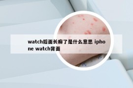 watch后面长癣了是什么意思 iphone watch背面