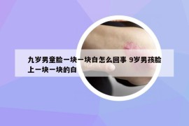 九岁男童脸一块一块白怎么回事 9岁男孩脸上一块一块的白