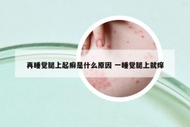 再睡觉腿上起癣是什么原因 一睡觉腿上就痒