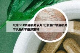 北京301银屑病关节炎 北京治疗银屑病关节炎最好的医院排名