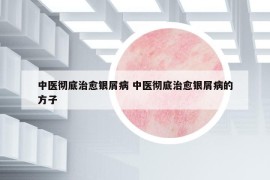 中医彻底治愈银屑病 中医彻底治愈银屑病的方子