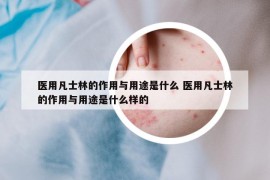 医用凡士林的作用与用途是什么 医用凡士林的作用与用途是什么样的