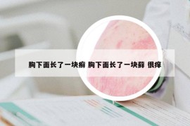 胸下面长了一块癣 胸下面长了一块藓 很痒