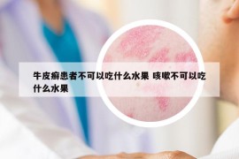 牛皮癣患者不可以吃什么水果 咳嗽不可以吃什么水果