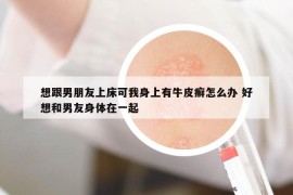 想跟男朋友上床可我身上有牛皮癣怎么办 好想和男友身体在一起