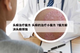 头癣治疗偏方 头癣的治疗小偏方 7偏方解决头癣烦恼