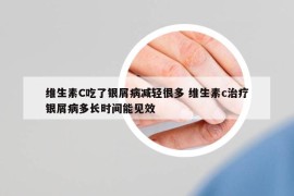 维生素C吃了银屑病减轻很多 维生素c治疗银屑病多长时间能见效