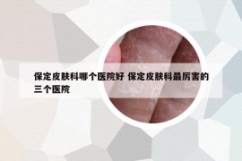 保定皮肤科哪个医院好 保定皮肤科最厉害的三个医院