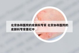 北京协和医院的皮肤科专家 北京协和医院的皮肤科专家晋红中