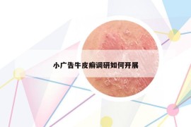 小广告牛皮癣调研如何开展