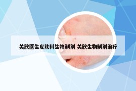 关欣医生皮肤科生物制剂 关欣生物制剂治疗