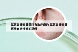 江苏省盱眙县医院有治疗癣的 江苏省盱眙县医院有治疗癣的药吗