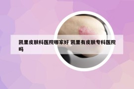 凯里皮肤科医院哪家好 凯里有皮肤专科医院吗