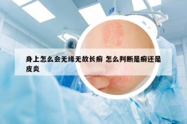 身上怎么会无缘无故长癣 怎么判断是癣还是皮炎