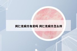 同仁克癣方有卖吗 同仁克癣方怎么样