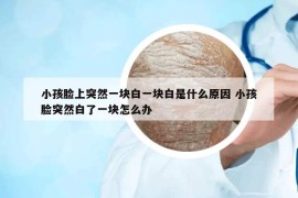 小孩脸上突然一块白一块白是什么原因 小孩脸突然白了一块怎么办