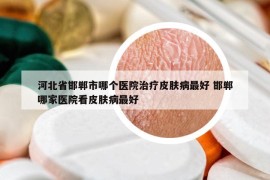 河北省邯郸市哪个医院治疗皮肤病最好 邯郸哪家医院看皮肤病最好