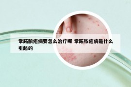 掌跖脓疱病要怎么治疗呢 掌跖脓疱病是什么引起的