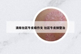 清除社区牛皮癣作文 社区牛皮鲜整治