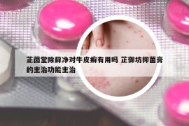 芷茵堂除藓净对牛皮癣有用吗 芷御坊抑菌膏的主治功能主治