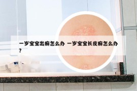 一岁宝宝出癣怎么办 一岁宝宝长皮癣怎么办?