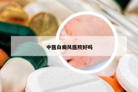 中医白癜风医院好吗