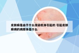 皮肤癣是由于什么侵染机体引起的 引起皮肤癣病的病原体是什么