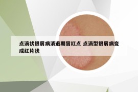 点滴状银屑病消退期冒红点 点滴型银屑病变成红片状