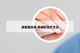 癣客服热线 癣病的治疗方法