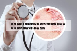 哈尔滨哪个银屑病医院最好的医院是哪家好 哈尔滨银屑病专科特色医院