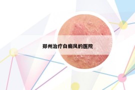 郑州治疗白癜风的医院