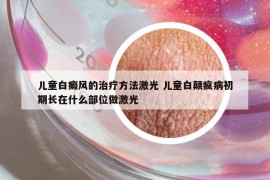 儿童白癜风的治疗方法激光 儿童白颠疯病初期长在什么部位做激光