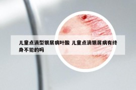 儿童点滴型银屑病叶酸 儿童点滴银屑病有终身不犯的吗