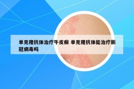 单克隆抗体治疗牛皮癣 单克隆抗体能治疗新冠病毒吗