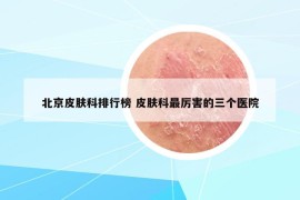 北京皮肤科排行榜 皮肤科最厉害的三个医院