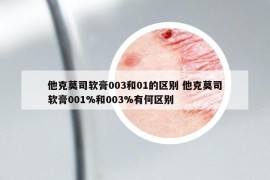 他克莫司软膏003和01的区别 他克莫司软膏001%和003%有何区别