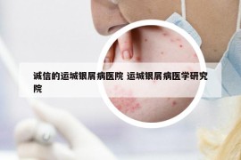 诚信的运城银屑病医院 运城银屑病医学研究院