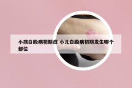 小孩白殿病初期症 小儿白殿病初期发生哪个部位