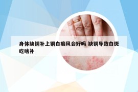 身体缺铜补上铜白癜风会好吗 缺铜导致白斑吃啥补