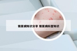 银屑病知识分享 银屑病科普知识