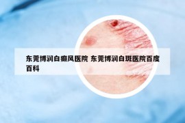 东莞博润白癫风医院 东莞博润白斑医院百度百科