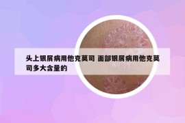 头上银屑病用他克莫司 面部银屑病用他克莫司多大含量的