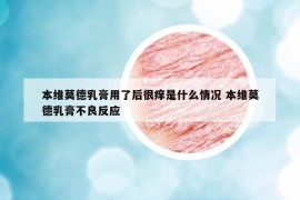 本维莫德乳膏用了后很痒是什么情况 本维莫德乳膏不良反应