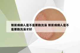 银屑病病人是不是要勤洗澡 银屑病病人是不是要勤洗澡才好