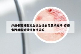 疗癣卡西甫散对血热血燥有效果吗知乎 疗癣卡西甫散对湿疹有疗效吗