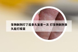 生物制剂打了后多久复查一次 打生物制剂多久能打疫苗