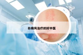 白癜风治疗的好中医