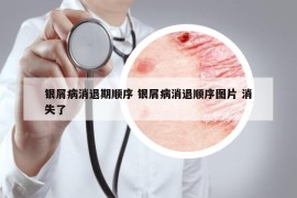 银屑病消退期顺序 银屑病消退顺序图片 消失了