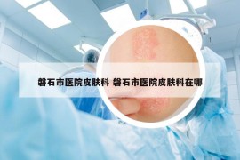 磐石市医院皮肤科 磐石市医院皮肤科在哪