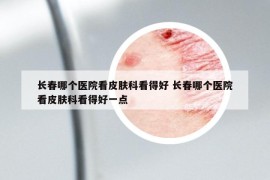 长春哪个医院看皮肤科看得好 长春哪个医院看皮肤科看得好一点